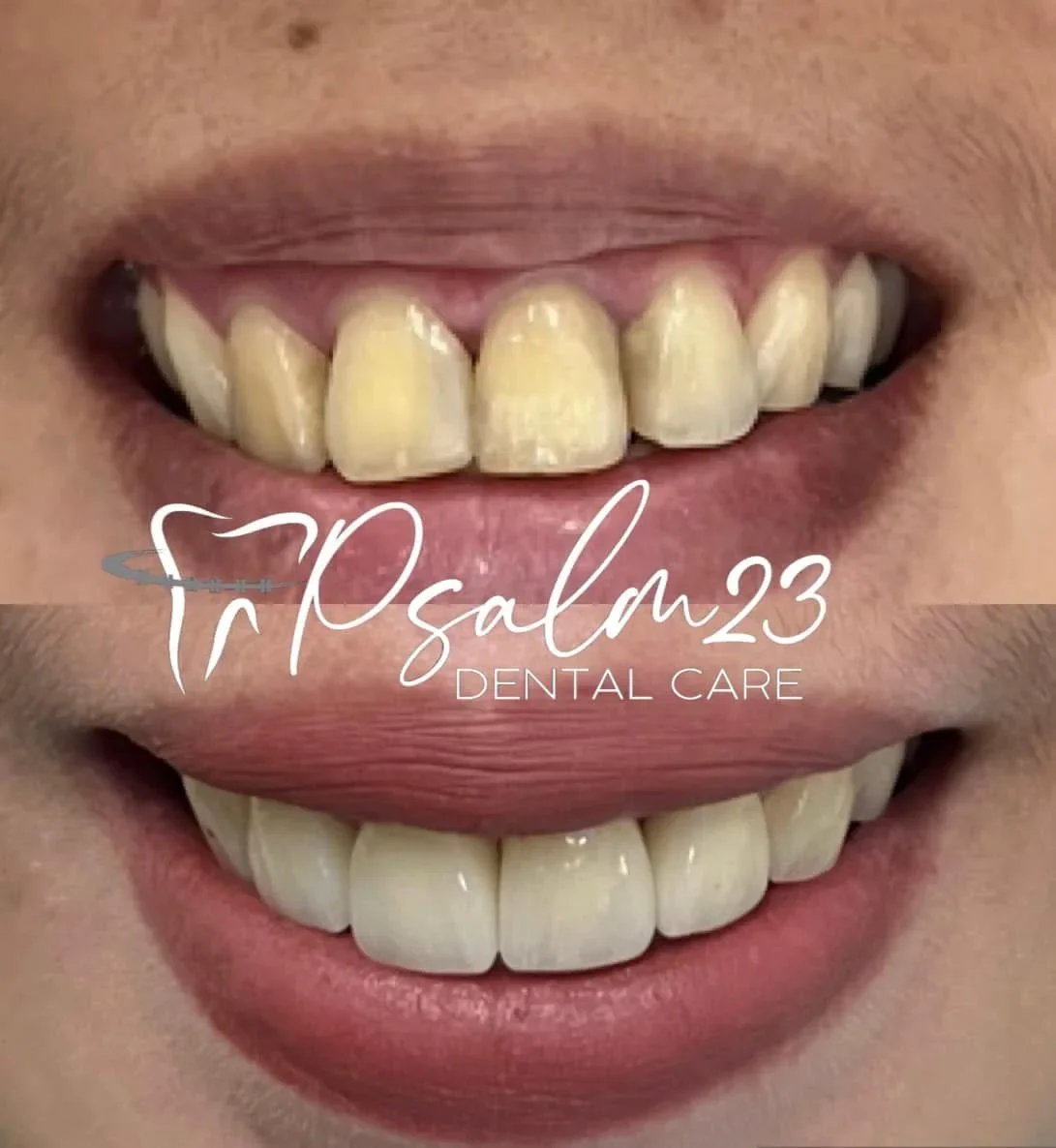 Psalm23 Dental Care cosmetic dentistry services — photo 7